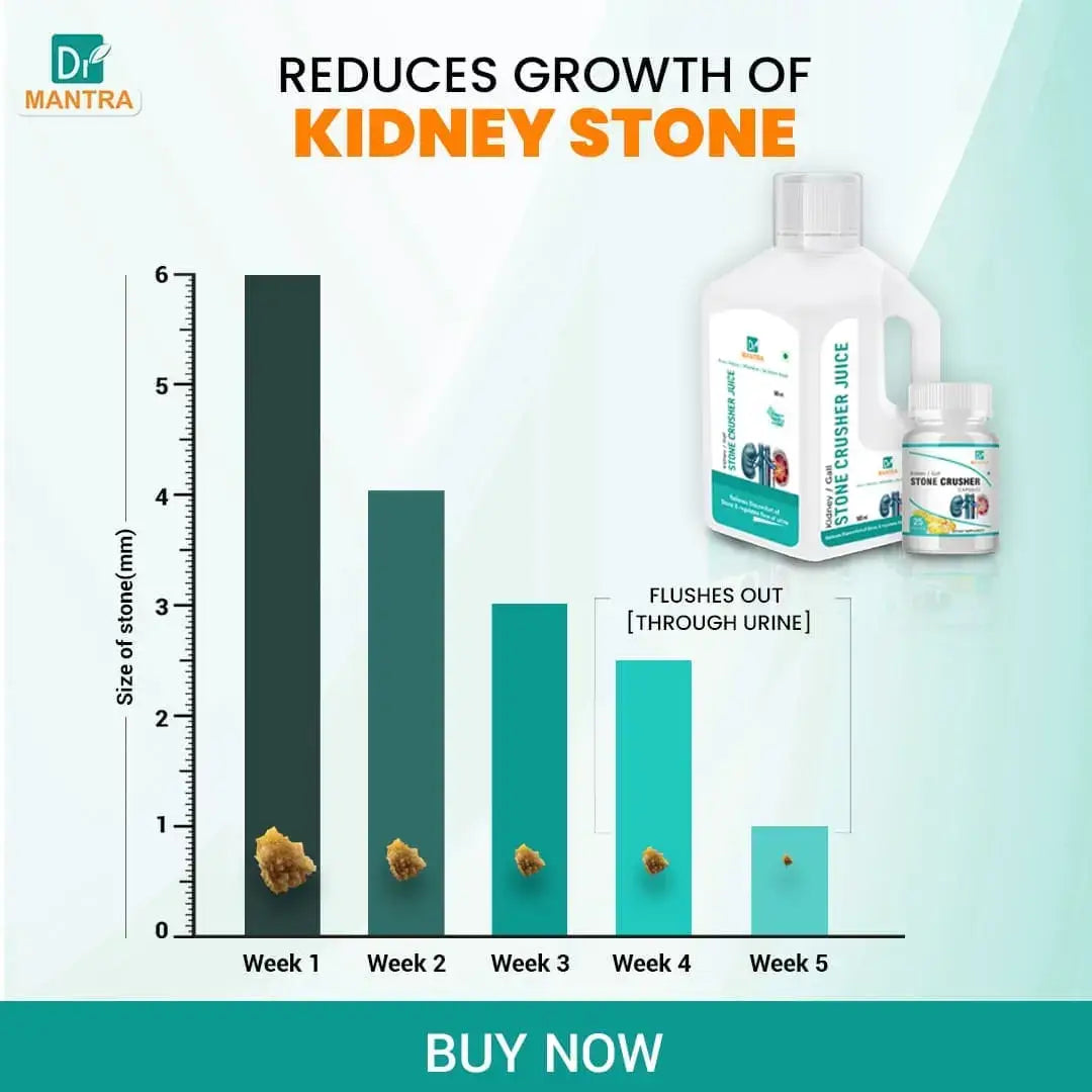 Flush Kidney Stones in 8-weeks with Dr. Mantra Kidney Stone Crusher Treatment Plan