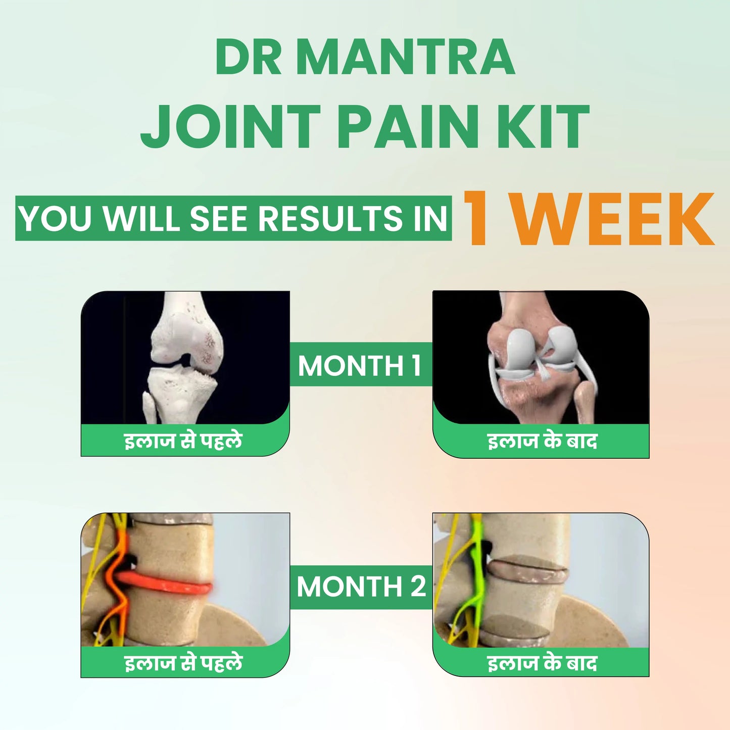 Say goodbye to Joint Pain in few weeks + Diet Chart + Doctor Consultation ( FREE)